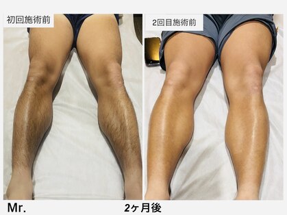 ミスター(Mr.)の写真