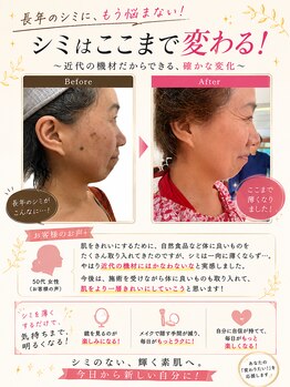 美容整体スズキ(SUZUKI)/すっぴんに自信が持てました