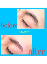 ニュアンス(nuance)/眉毛脱毛