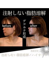 クリニカルボーテ 心斎橋院(CLINICAL BEAUTE)/小顔はデコルテから作る！