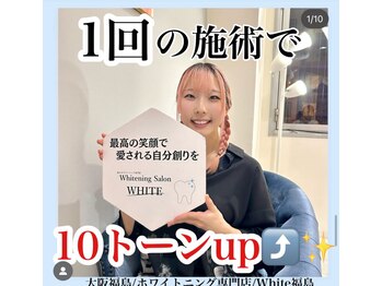 ホワイトニングサロン ホワイト(WHITE)/セルフホワイトニング/大阪/福島