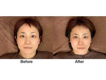 こじま 富雄団地接骨院/Before&After