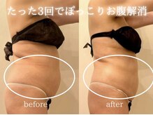 クロレ 浦和店(CLORE)の雰囲気（３回の施術でお腹スッキリ◎代謝もUPして全身痩せの効果も有り）