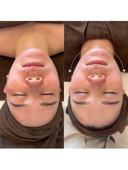 プラウ(Plau)/浮腫み撃退×リフトアップ