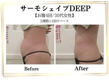 スパイア(SPIRE)の雰囲気（サーモシェイプDEEPお腹7回のお客様♪痩身/小顔/フェイシャル）