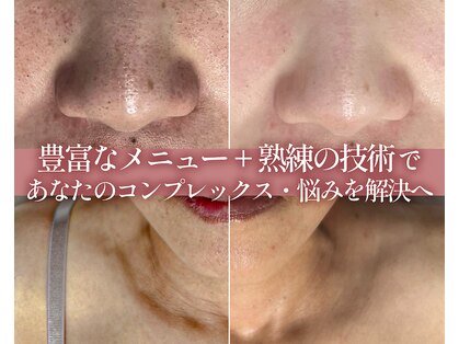 サバーイ サバーイ(SABAHI SABAHI)の写真