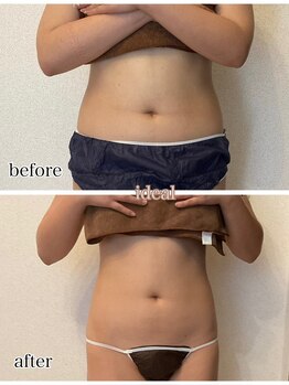 イデアル 箱崎(ideal)/