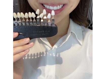 ホワイトニングバー 福島店の写真