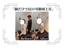 鍼灸整体院ユー(鍼灸整体院You...)/before/after