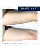 メンズクリア 高知帯屋町店/【メンズクリア】お客様の施術例