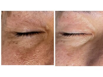 サロンドシー(SALON de C.)/しわ・ごわつき改善