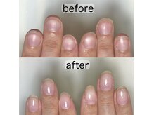 フェミニンネイル(Feminine Nail)
