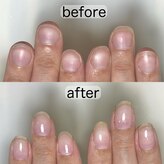 フェミニンネイル(Feminine Nail)