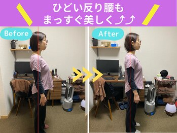 京都中丸整体カイロプラクティック/産後の骨盤矯正