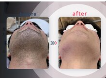 シュシュエステプリューム(Chou Chou Esthe PLUME)/