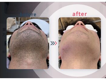 シュシュエステプリューム(Chou Chou Esthe PLUME)/