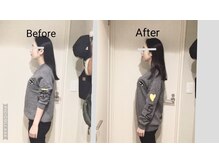 ショウフェイスデザイン(Sho Face Design)/《小顔矯正》ビフォーアフター