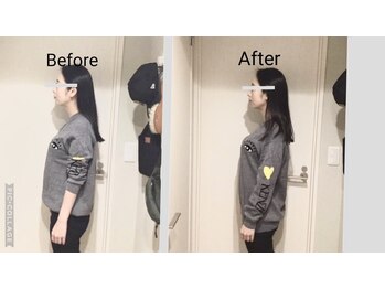 ショウフェイスデザイン(Sho Face Design)/《小顔矯正》ビフォーアフター