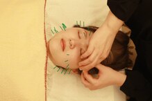 リボディ美容鍼灸院(Re±body美容鍼灸院)