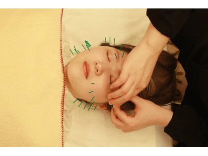 リボディ美容鍼灸院(Re±body美容鍼灸院)の写真