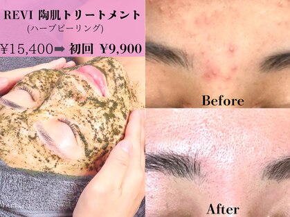 シード(SHE°)の写真