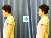 いのくち接骨院/姿勢改善の症例