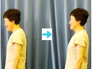 いのくち接骨院/姿勢改善の症例