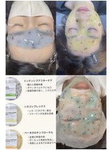 アトリエリン 小牧本店(Atelier Rin)/ハイドロジェリーマスク