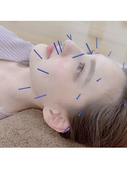 リアン(Re:an)/美容鍼