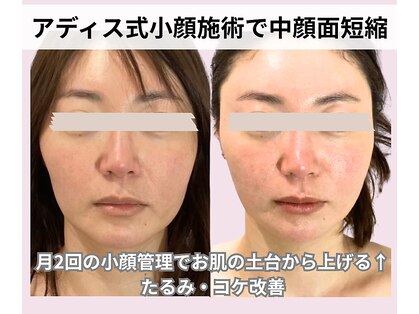 アディス 心斎橋(ADISE)の写真