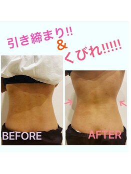 ラクシュミー/痩身◆ビフォーアフター