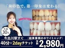 ホワイトニングショップ 今出川店(WHITENING SHOP)