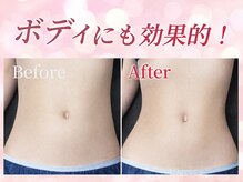 小顔専門店Lift(痩身・リフト)栄/小顔専門店Lift｜小顔施術