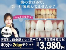ホワイトニングショップ 四条店