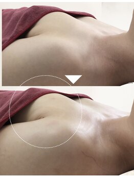 ヴェルナ(VELUNA)/☆30代・授乳経験ありのお客様☆