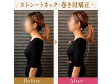 にしやま整骨院の雰囲気（ストレートネック、巻き肩、反り腰を整えて美しい健康的な姿勢へ）