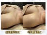 ★人気No.2★ 【削げデコルテ・ハリ不足】上胸ふっくら◆ 美集中ケア