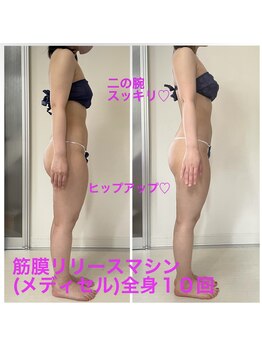 セルビューティー(Cell Beauty)/30代、筋膜リリース全身10回