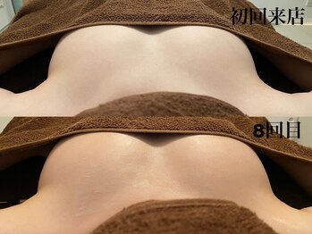 整顔整頭/スタンダードバストケア（8回）