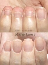 マリーロール 梅田店(Marie Laure)/深爪矯正/自爪育成/自爪風