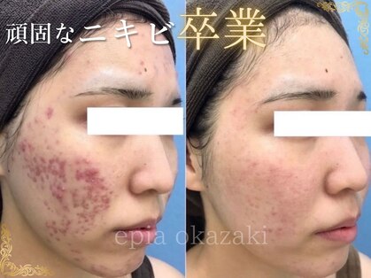 エピア 岡崎店(Epia)の写真