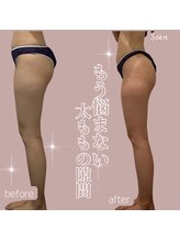 ソワン(Soin)/30代　下半身