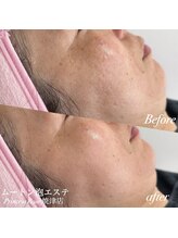 プリンセスローズ 焼津店(Princess Rose)/ムートン泡エステ