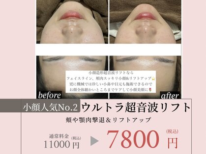 エンチャント(ENCHANT)の写真