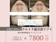 エンチャント(ENCHANT)の写真