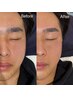 【メンズ専用】これで決まり☆美眉スタイリング ＋ クセになる男のツル艶肌