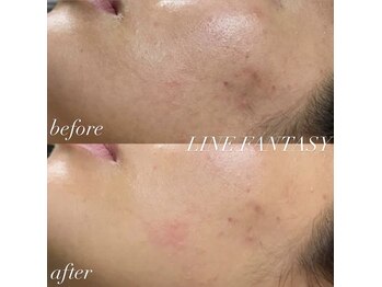 ラインファンタジー 武庫之荘店