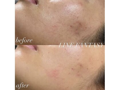 ラインファンタジー 武庫之荘店の写真