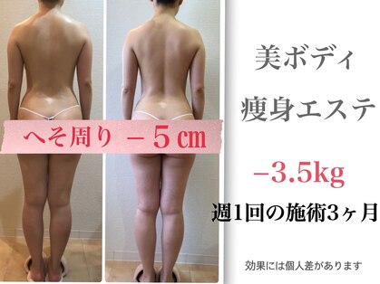 カロン(Kalon)の写真