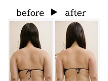 サロン ド ユキフラン(Salon de Yukifranc)/施術部位→肩甲骨・二の腕